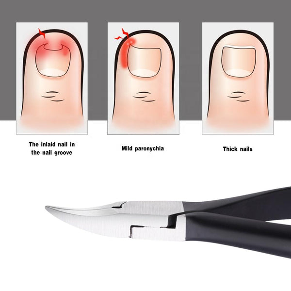 Zware Nageltang voor Teennagels | Medies®